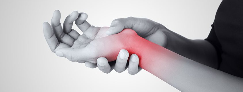 Is Carpal Tunnel Syndrome (CTS) a daily struggle for you?